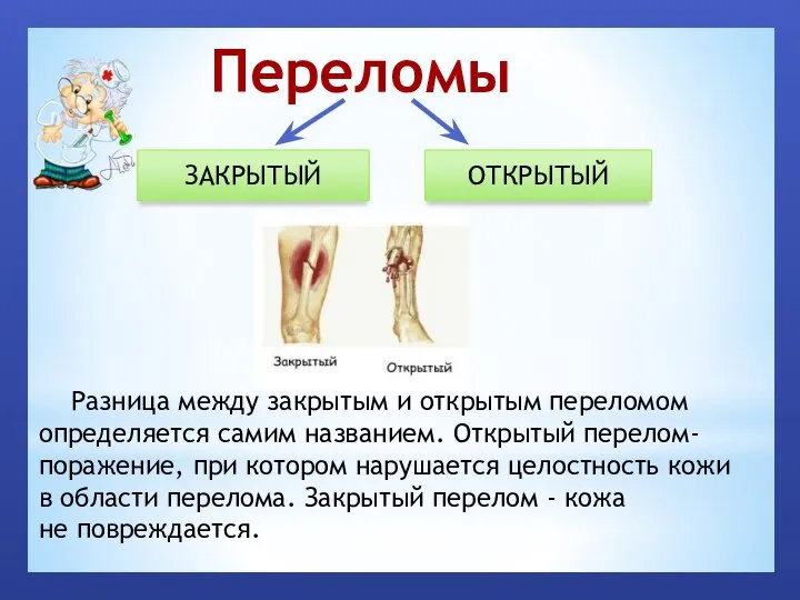 Переломы ЗАКРЫТЫЙ ОТКРЫТЫЙ Разница между закрытым и открытым переломом определяется самим