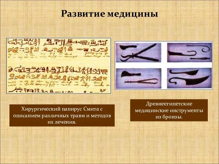 Древнеегипетские медицинские инструменты из бронзы. Развитие медицины Хирургический папирус Смита с