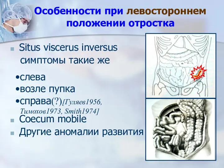 Особенности при левостороннем положении отростка Situs viscerus inversus симптомы такие же