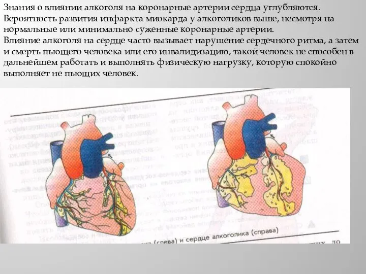 Знания о влиянии алкоголя на коронарные артерии сердца углубляются. Вероятность развития