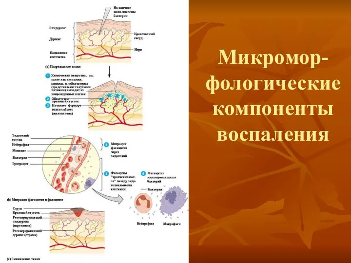 Микромор-фологические компоненты воспаления