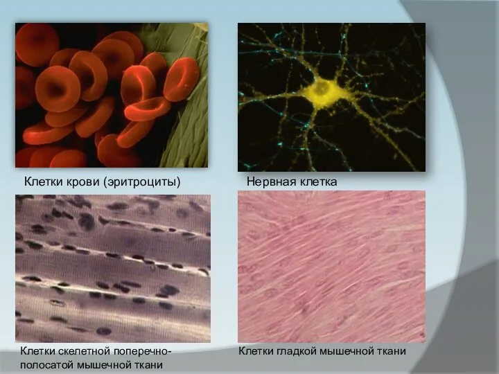 Клетки крови (эритроциты) Нервная клетка Клетки скелетной поперечно-полосатой мышечной ткани Клетки гладкой мышечной ткани