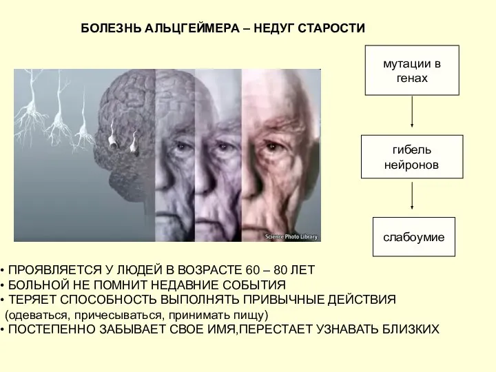 БОЛЕЗНЬ АЛЬЦГЕЙМЕРА – НЕДУГ СТАРОСТИ ПРОЯВЛЯЕТСЯ У ЛЮДЕЙ В ВОЗРАСТЕ 60