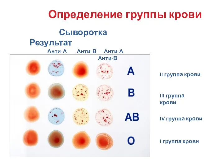 II группа крови III группа крови IV группа крови I группа