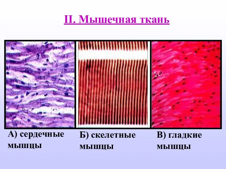 II. Мышечная ткань А) сердечные мышцы Б) скелетные мышцы В) гладкие мышцы