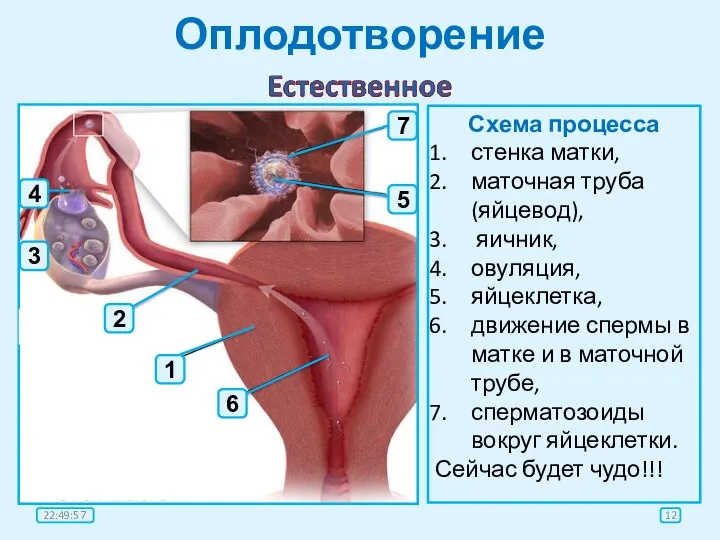 Оплодотворение Схема процесса стенка матки, маточная труба (яйцевод), яичник, овуляция, яйцеклетка,