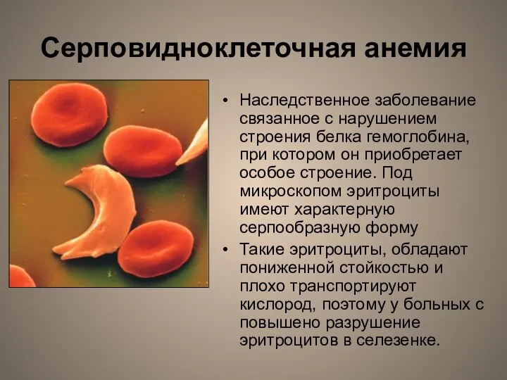 Серповидноклеточная анемия Наследственное заболевание связанное с нарушением строения белка гемоглобина, при