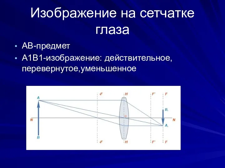 Изображение на сетчатке глаза АВ-предмет А1В1-изображение: действительное,перевернутое,уменьшенное