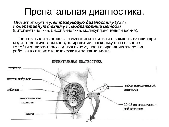 Пренатальная диагностика. Она использует и ультразвуковую диагностику (УЗИ), и оперативную технику