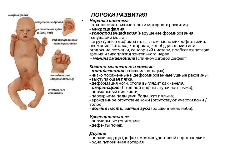 ПОРОКИ РАЗВИТИЯ Нервная система: - отклонения психического и моторного развития; -