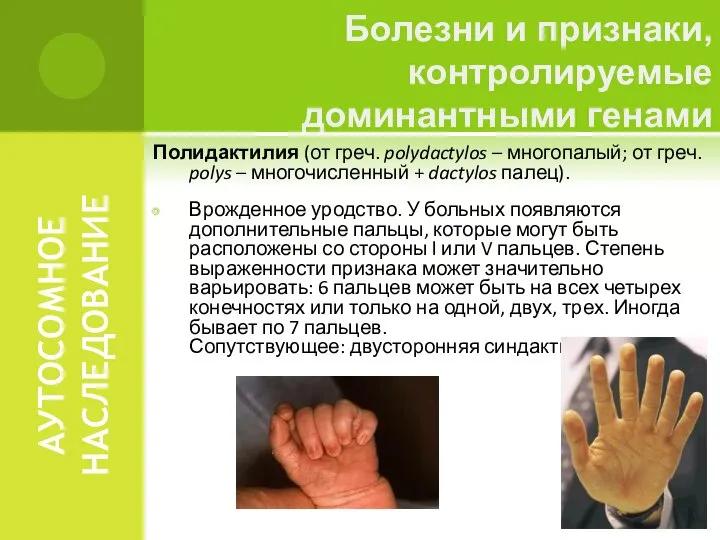 АУТОСОМНОЕ НАСЛЕДОВАНИЕ Полидактилия (от греч. polydactylos – многопалый; от греч. polys