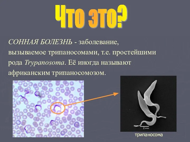 СОННАЯ БОЛЕЗНЬ - заболевание, вызываемое трипаносомами, т.е. простейшими рода Trypanosoma. Её