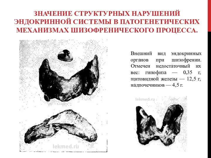 Значение структурных нарушений эндокринной системы в патогенетических механизмах шизофренического процесса. Внешний