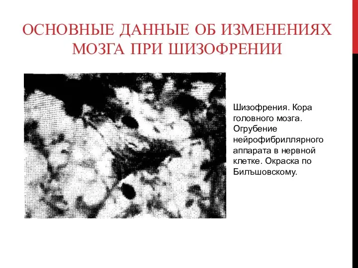 Основные данные об изменениях мозга при шизофрении Шизофрения. Кора головного мозга.