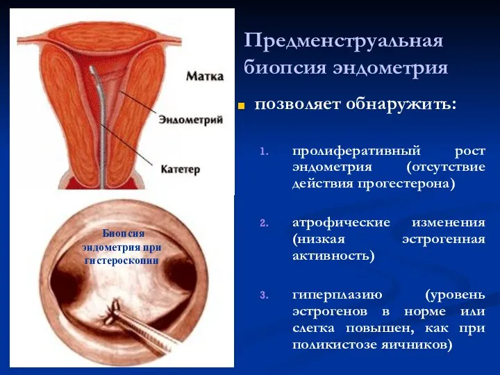 Предменструальная биопсия эндометрия позволяет обнаружить: пролиферативный рост эндометрия (отсутствие действия прогестерона)