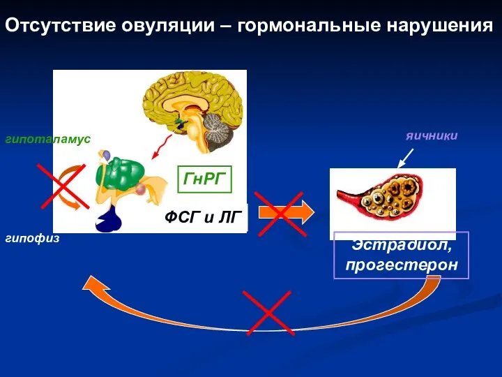 гипоталамус гипофиз ГнРГ ФСГ и ЛГ Эстрадиол, прогестерон яичники Отсутствие овуляции – гормональные нарушения