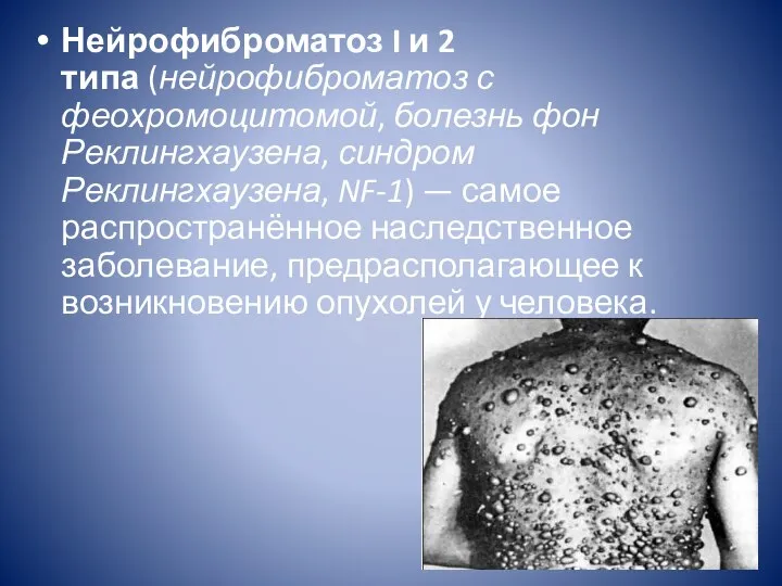 Нейрофиброматоз I и 2 типа (нейрофиброматоз с феохромоцитомой, болезнь фон Реклингхаузена,