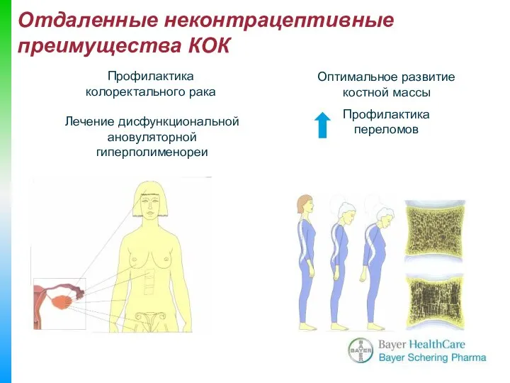 Профилактика колоректального рака Лечение дисфункциональной ановуляторной гиперполименореи Оптимальное развитие костной массы