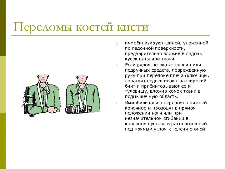 Переломы костей кисти иммобилизируют шиной, уложенной по ладонной поверхности, предварительно вложив