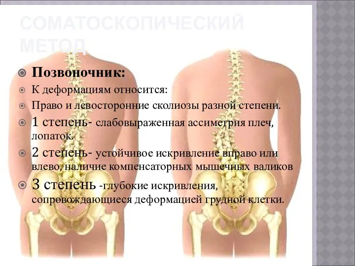 СОМАТОСКОПИЧЕСКИЙ МЕТОД Позвоночник: К деформациям относится: Право и левосторонние сколиозы разной