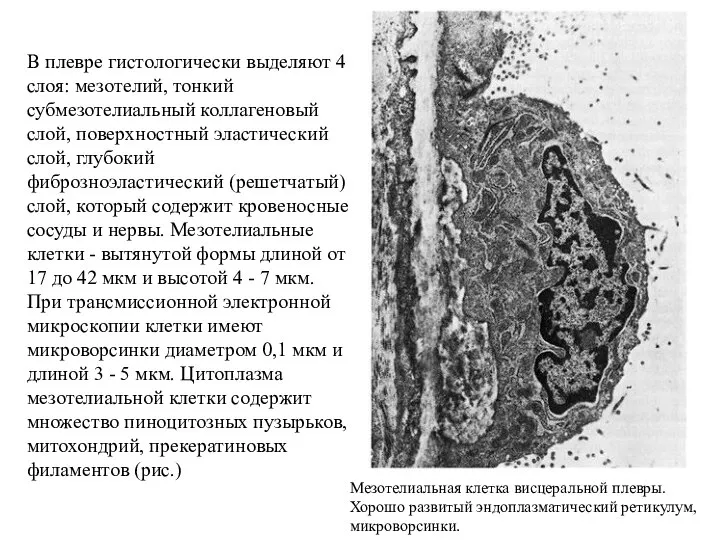 В плевре гистологически выделяют 4 слоя: мезотелий, тонкий субмезотелиальный коллагеновый слой,