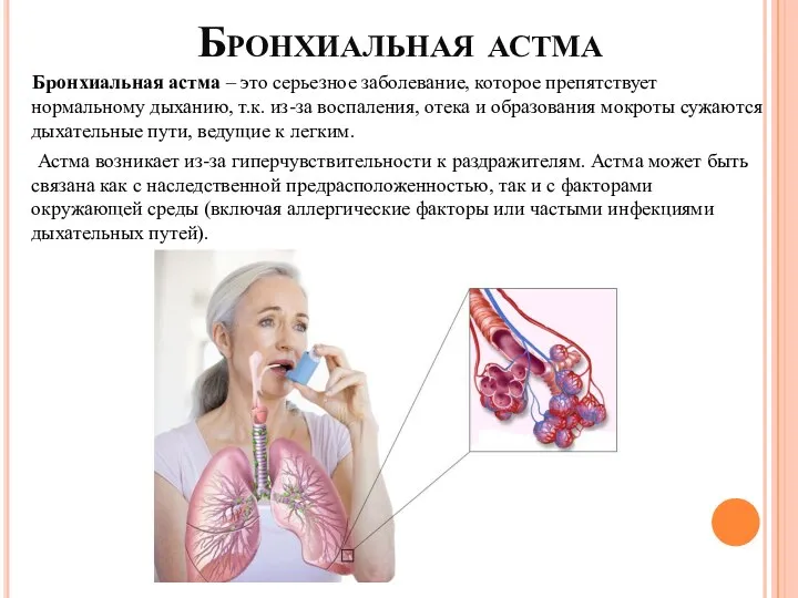 Бронхиальная астма Бронхиальная астма – это серьезное заболевание, которое препятствует нормальному