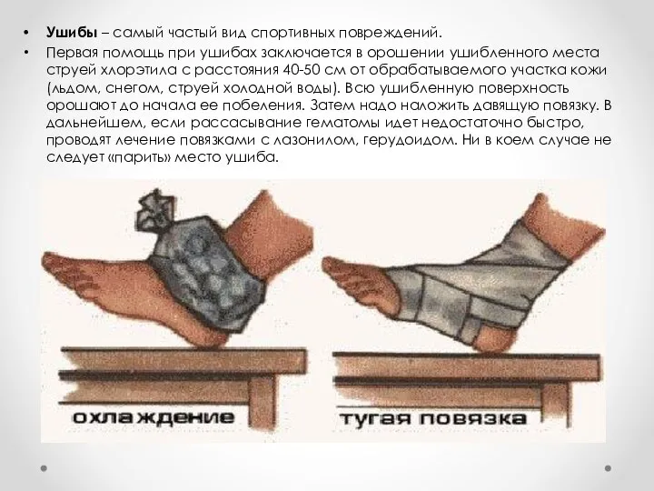 Ушибы – самый частый вид спортивных повреждений. Первая помощь при ушибах