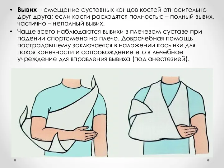 Вывих – смещение суставных концов костей относительно друг друга; если кости