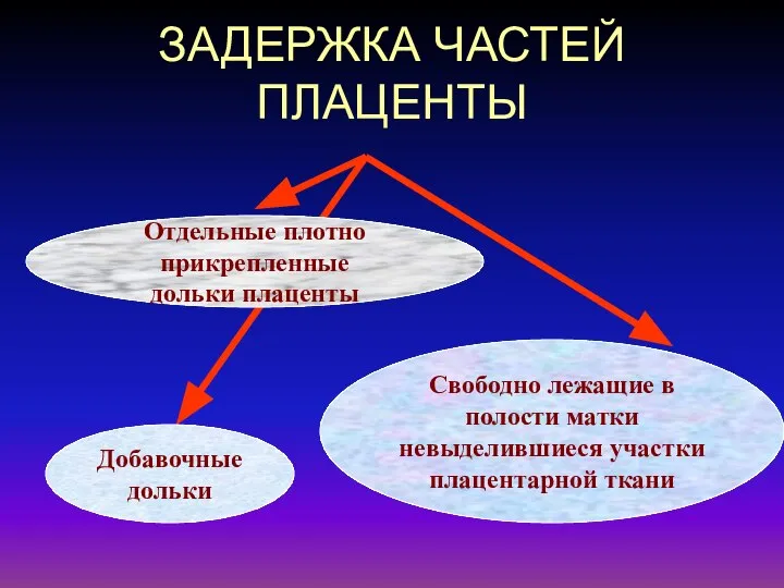 ЗАДЕРЖКА ЧАСТЕЙ ПЛАЦЕНТЫ Отдельные плотно прикрепленные дольки плаценты Добавочные дольки Свободно