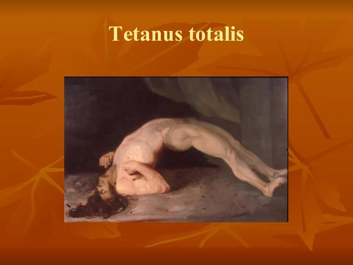 Тetanus totalis