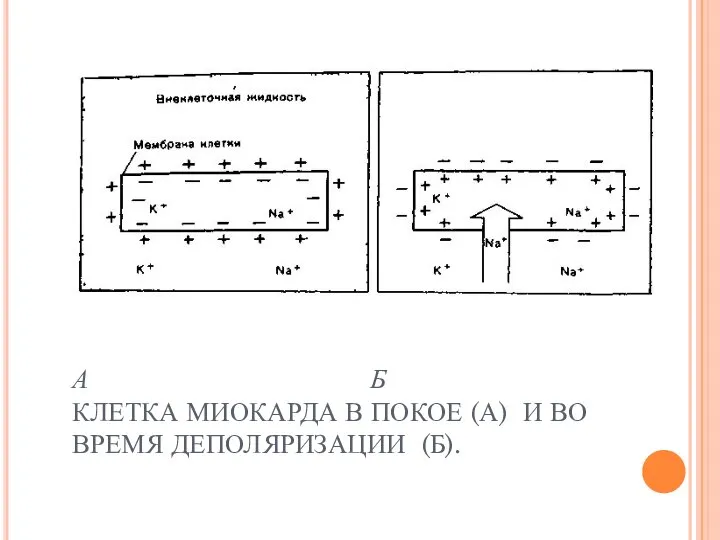 А Б КЛЕТКА МИОКАРДА В ПОКОЕ (А) И ВО ВРЕМЯ ДЕПОЛЯРИЗАЦИИ (Б).