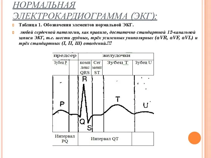 НОРМАЛЬНАЯ ЭЛЕКТРОКАРДИОГРАММА (ЭКГ): Таблица 1. Обозначения элементов нормальной ЭКГ. любой сердечной