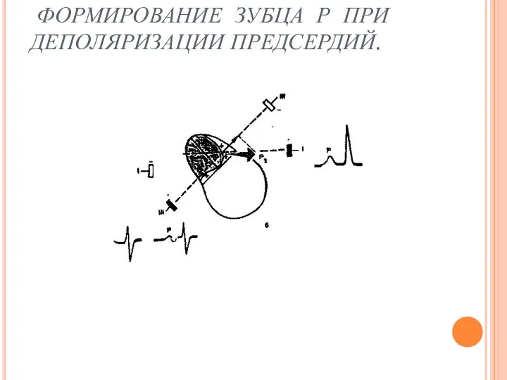 ФОРМИРОВАНИЕ ЗУБЦА Р ПРИ ДЕПОЛЯРИЗАЦИИ ПРЕДСЕРДИЙ.