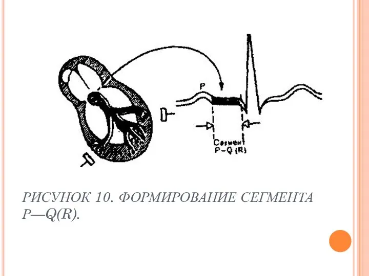 РИСУНОК 10. ФОРМИРОВАНИЕ СЕГМЕНТА Р—Q(R).