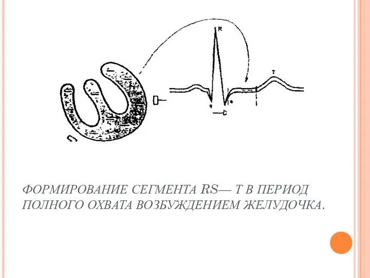 ФОРМИРОВАНИЕ СЕГМЕНТА RS— Т В ПЕРИОД ПОЛНОГО ОХВАТА ВОЗБУЖДЕНИЕМ ЖЕЛУДОЧКА.