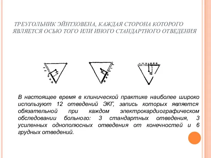 ТРЕУГОЛЬНИК ЭЙНТХОВЕНА, КАЖДАЯ СТОРОНА КОТОРОГО ЯВЛЯЕТСЯ ОСЬЮ ТОГО ИЛИ ИНОГО СТАНДАРТНОГО