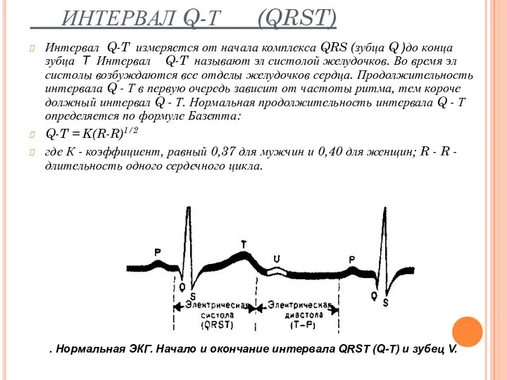 ИНТЕРВАЛ Q-Т (QRST) Интервал Q-T измеряется от начала комплекса QRS (зубца