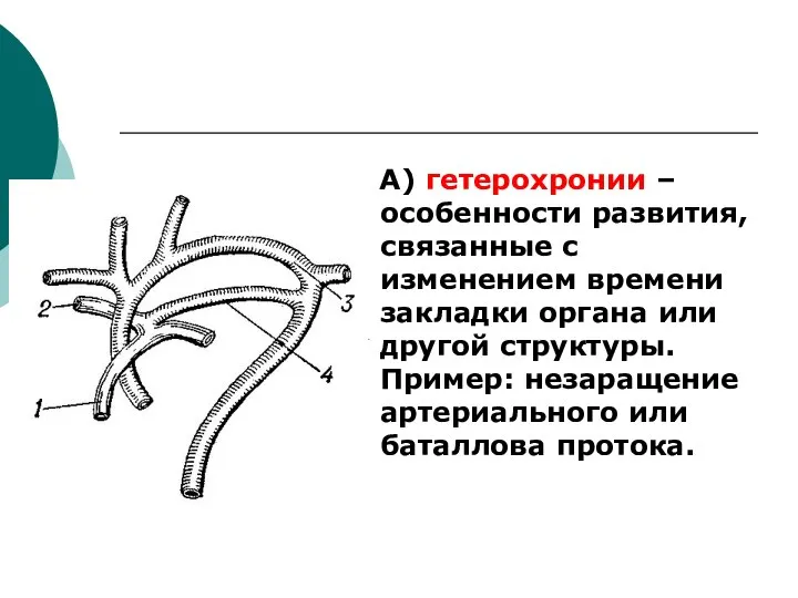 А) гетерохронии – особенности развития, связанные с изменением времени закладки органа