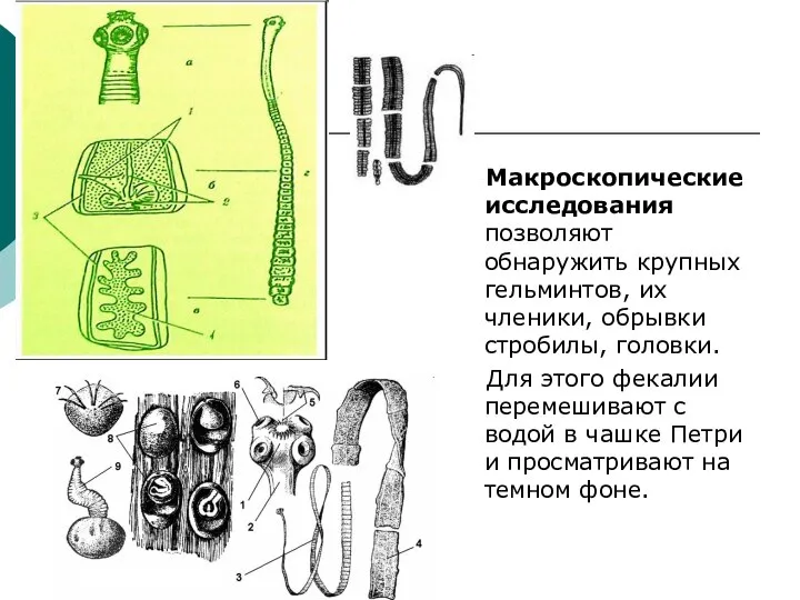 Макроскопические исследования позволяют обнаружить крупных гельминтов, их членики, обрывки стробилы, головки.