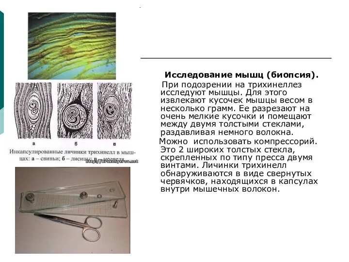 Исследование мышц (биопсия). При подозрении на трихинеллез исследуют мышцы. Для этого