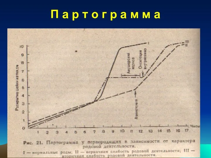 П а р т о г р а м м а