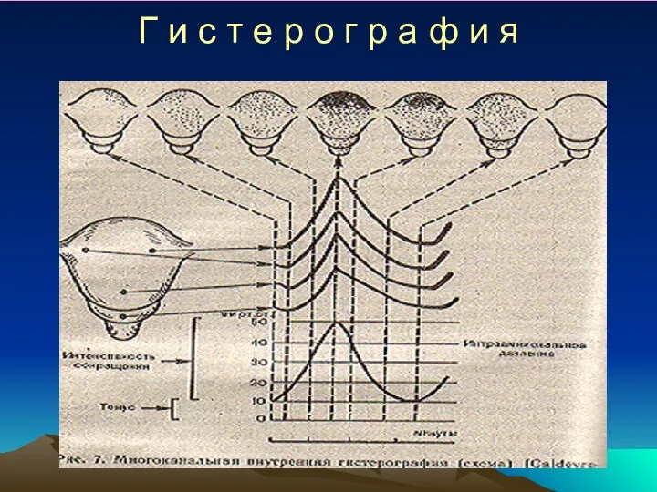 Г и с т е р о г р а ф и я