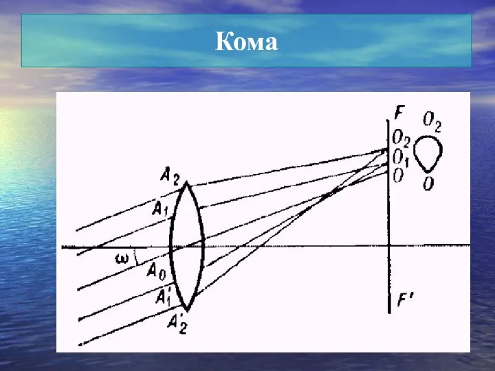 Кома