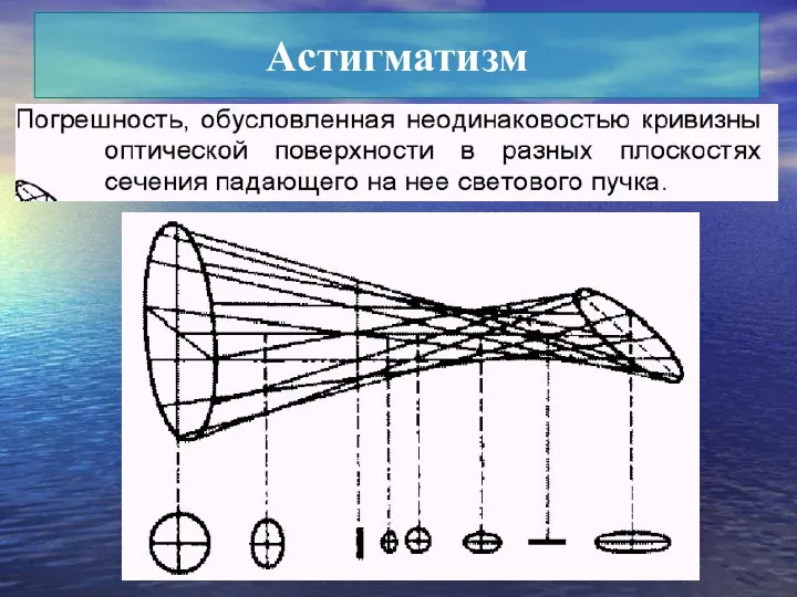 Астигматизм