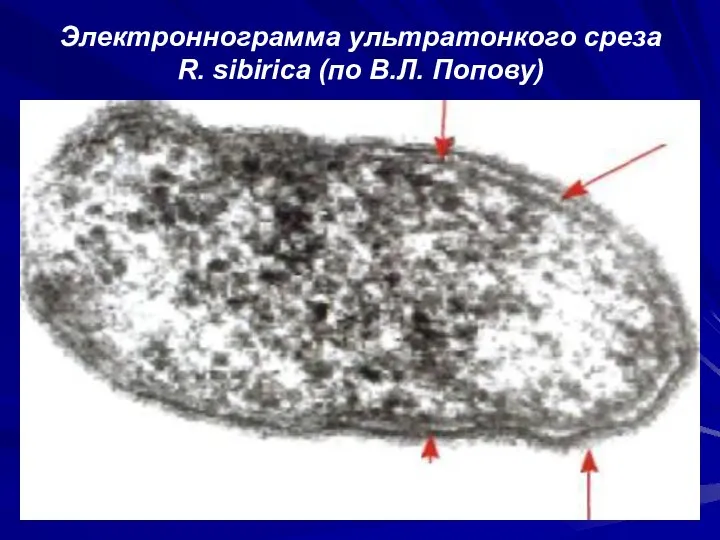 Электроннограмма ультратонкого среза R. sibirica (по В.Л. Попову)