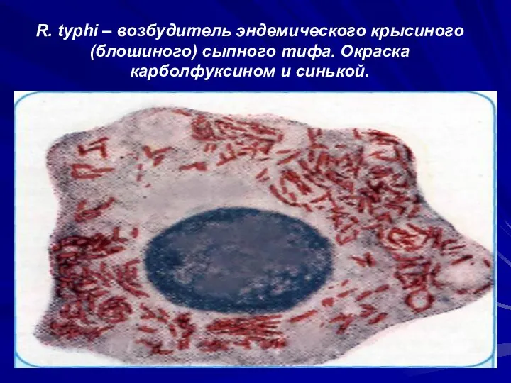 R. typhi – возбудитель эндемического крысиного (блошиного) сыпного тифа. Окраска карболфуксином и синькой.