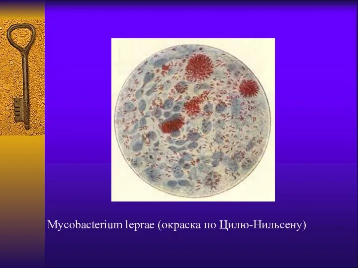 Mycobacterium leprae (окраска по Цилю-Нильсену)
