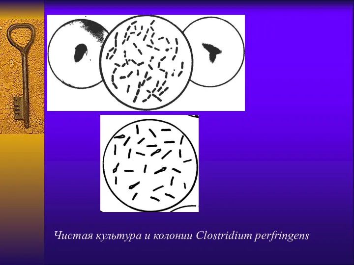 Чистая культура и колонии Clostridium perfringens