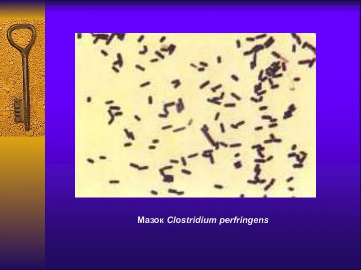 Мазок Clostridium perfringens