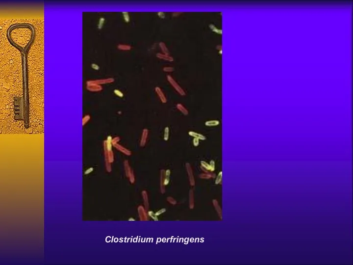 Clostridium perfringens